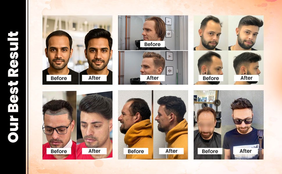 Double Base Front Line